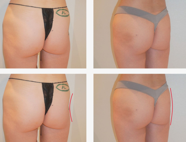 Image may contain Body Part Person Thigh Skin and Tattoo